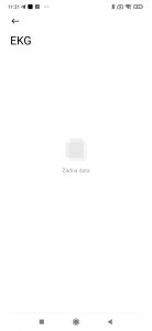 EKG
